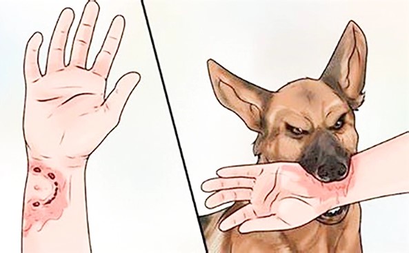 Bộ Y tế: Người dân cần chủ động các biện pháp phòng tránh bệnh dại