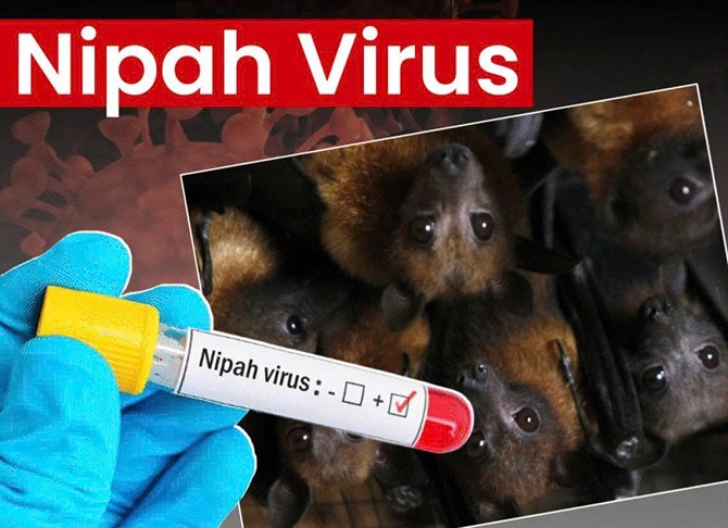 Dịch bệnh do vi rút Nipah và khuyến cáo của ngành y tế