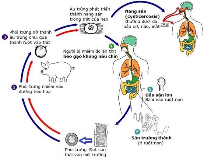 Bệnh sán dây lợn và các biện pháp phòng bệnh
